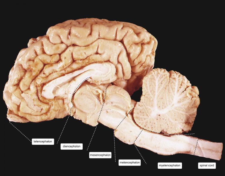 Cow Brain Compartments Anatomie en Neurowetenschappen